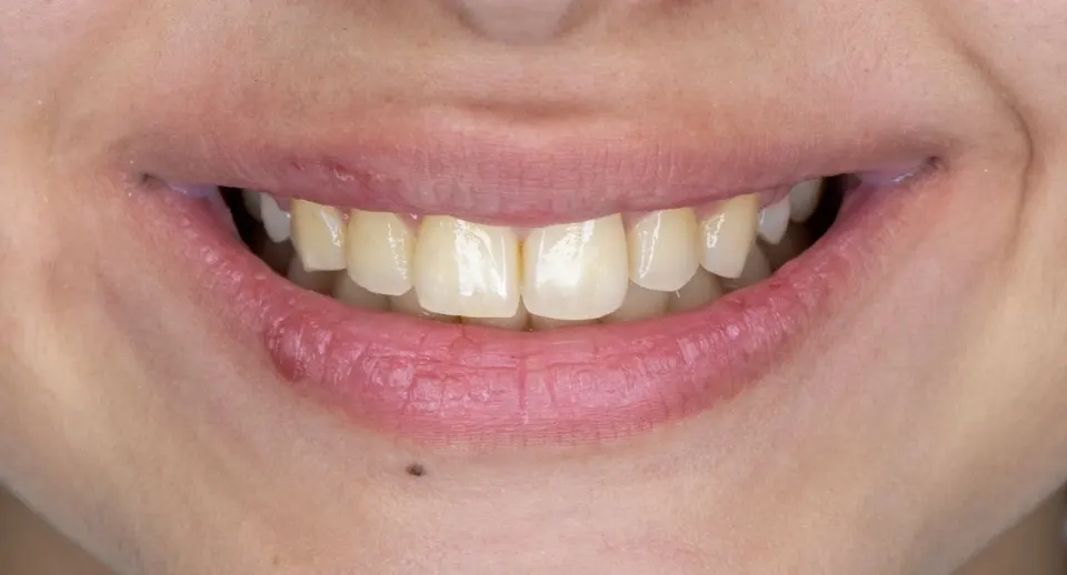 فتوگرافی پزشکی تکرنگ طب