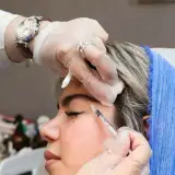 مرکز لیزر دلتا در تهران
