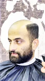 کلینیک تخصصی پروتز موی آرا در شهریار