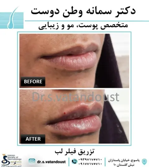 دکتر سمانه وطن دوست متخصص پوست، مو و زیبایی
