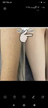 کلینیک لیزر پریسا