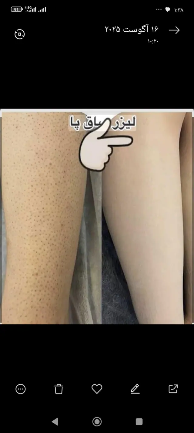 کلینیک لیزر پریسا