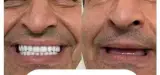 دندانسازی محلات ( مرصاد )