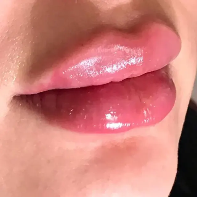 کلینیک زیبایی دکتر میثم رمضانپور خاکی