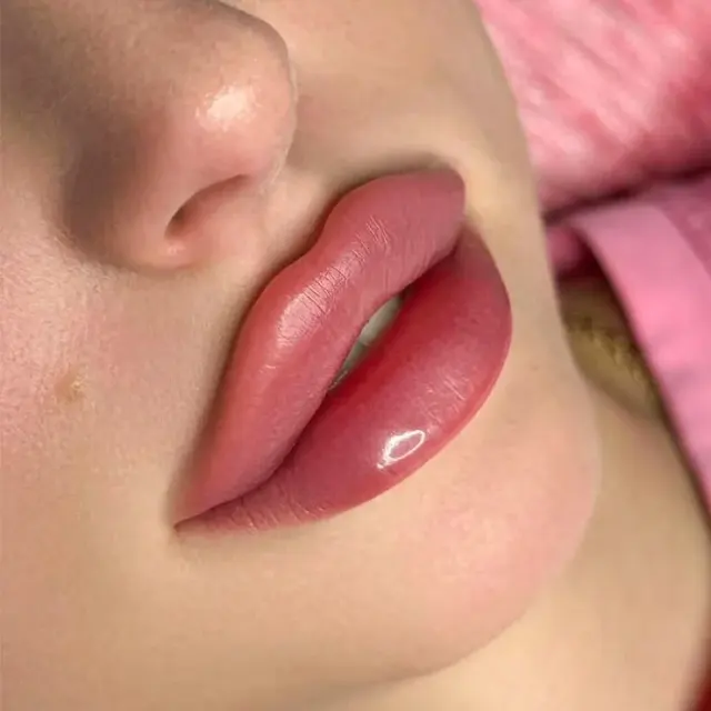 کلینیک زیبایی ایپک