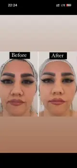 کلینیک زیبایی و لاغری زهرا انجمنی