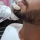 مطب زیبایی بهسان