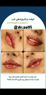 کلینیک پوست مو و زیبایی دکتر زلفی