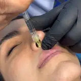 دکتر منصور هادیلو فوق تخصص جراحی پلاستیک و زیبایی