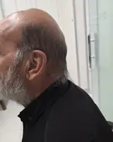شنوایی سنجی طنین