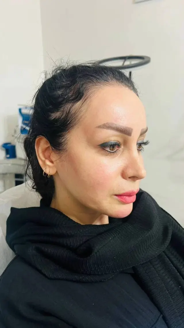 کلینیک زیبایی هستی