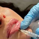 کلینیک زیبایی دکتر خلیل طلایی زاده