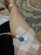 تزریقات