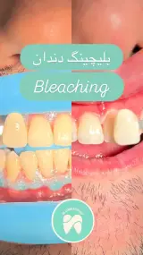 مطب دندانپزشکی دکتر سیده زهرا پسته ای