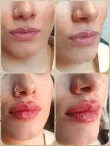 مطب پوست و مو دکتر نسرین نقدی پور
