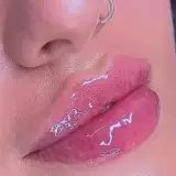 کلینیک لیزر پوست مو زیبایی یاس
