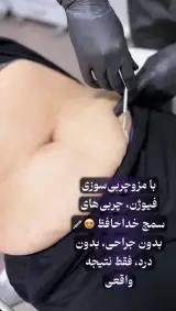 کلینیک زیبایی،لاغری لمیس