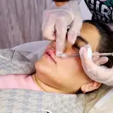 مرکز لیزر دی
