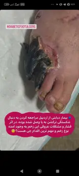 متخصص مراقبت و ترمیم زخم