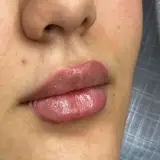 کلینیک پوست مو و زیبایی یلدا