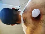 طب سنتی و طب سوزنی شفا