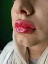 مطب زیبایی دکتر توحیده جهاندیده