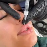 دکتر رضا نعمتی شیراز»»» فول فیس و بادی