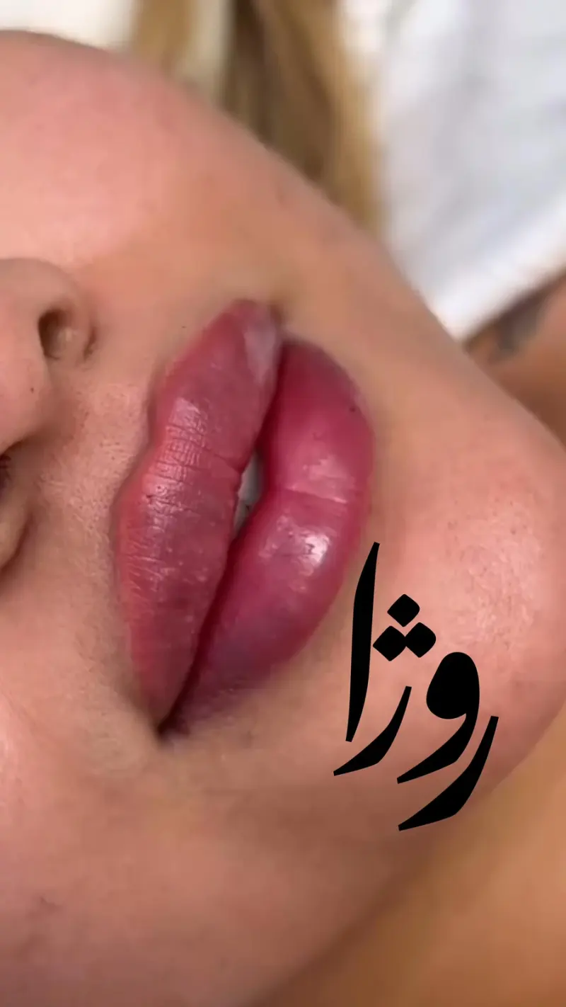 مرکز لیزر روژا