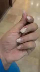 کاشت و ترمیم ناخن شادی