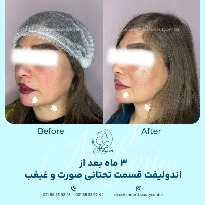 دکتر مولود اسکندری