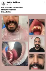 کلینیک تخصصی دندانپزشکی و ایمپلنت الین
