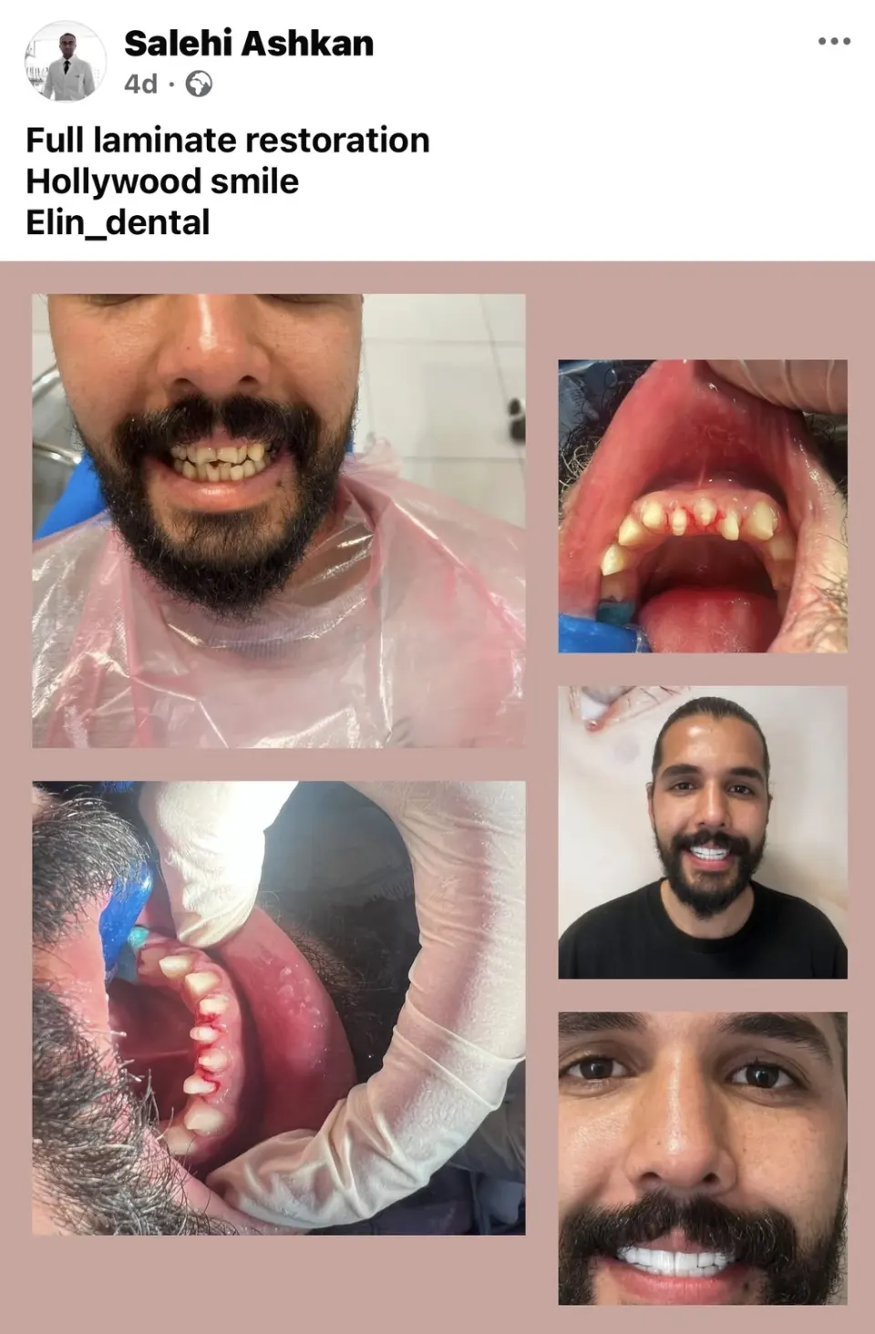 کلینیک تخصصی دندانپزشکی و ایمپلنت الین