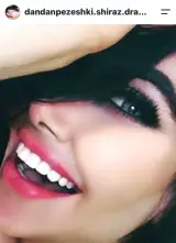 دکتر حسین اکبری دندانپزشک (زیبایی)