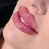 مرکز زیبایی و لیزر سکرت