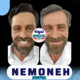 ساخت پروتز دندان مصنوعی دکتر محمود حبیبی در ستارخان تهران
