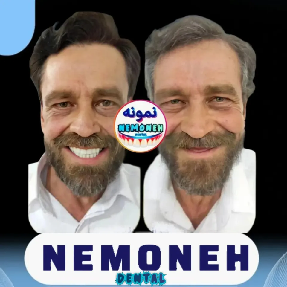 ساخت پروتز دندان مصنوعی دکتر محمود حبیبی در ستارخان تهران