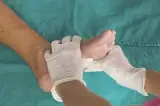 درمان زخم علیرضا منصوری