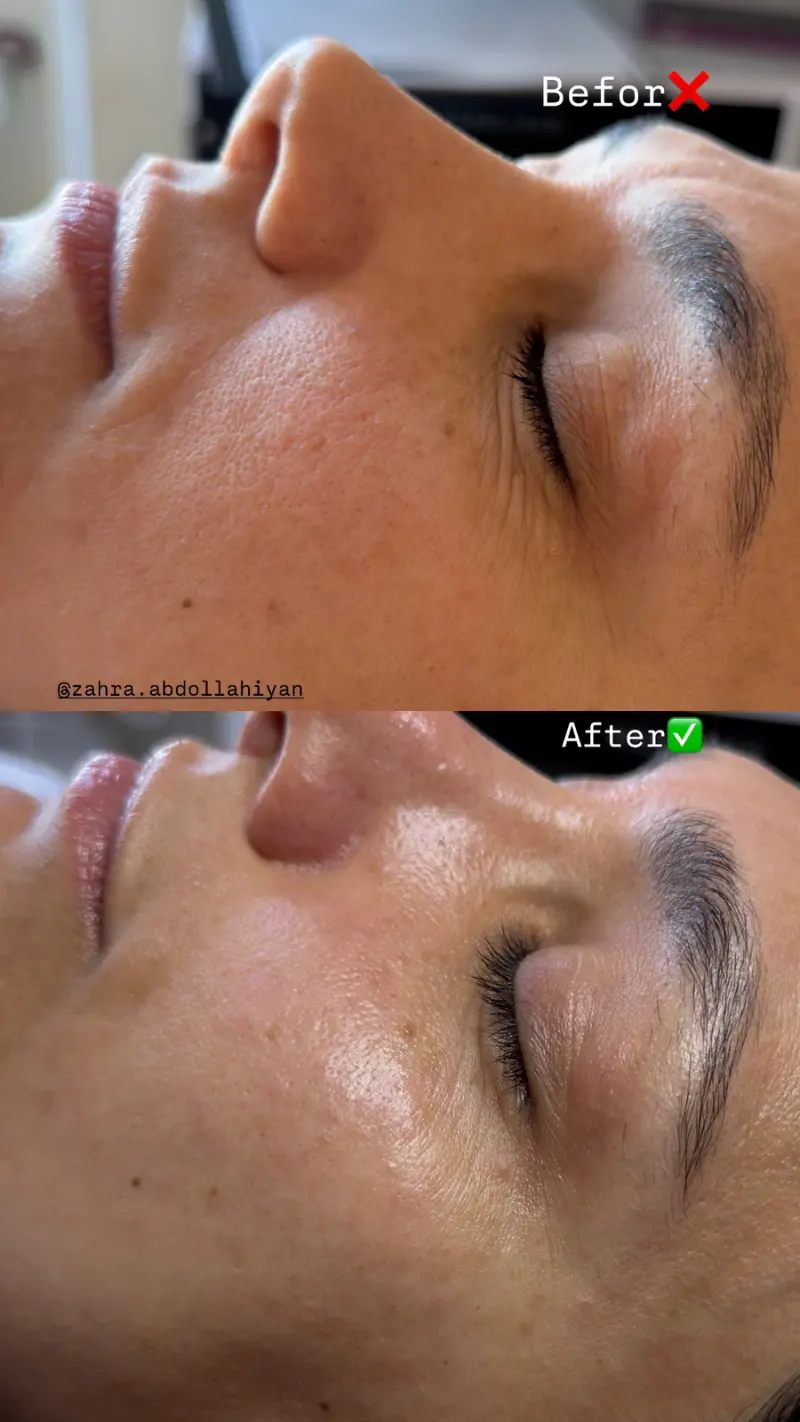 پاکسازی پوست و‌فیشال تخصصی زهراعبدالهیان