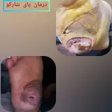 کلینیک درمان زخم ارومیه