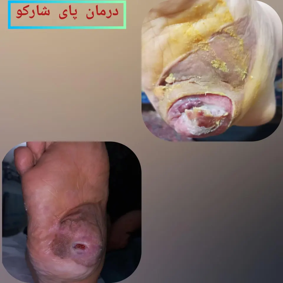 کلینیک درمان زخم ارومیه
