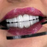 دنتال ونیز