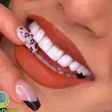 ايمپلنت_زیبایی_درمانهای تخصصی