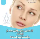 لابیا ولایتی و تزریق ژل به واژن