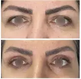 دکتر الهام علی پور/متخصص و جراح پوست و مو/بندرعباس
