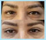 دکتر اسداله کاکایی/لیزیک و بلفاروپلاستی رشت