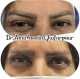 دکتر امیرحسین غفارپور،چشم پزشک