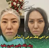دکتر حمید آزادی/متخصص چشم و لیزیک،جراحی زیبایی پلک و بلفارو