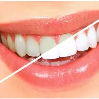 ♥️کلینیک دندانپزشکی زعفرانیه♥️