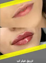 مطب پوست مو زیبایی سابرینا