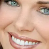 دندانپزشکی زیبایی